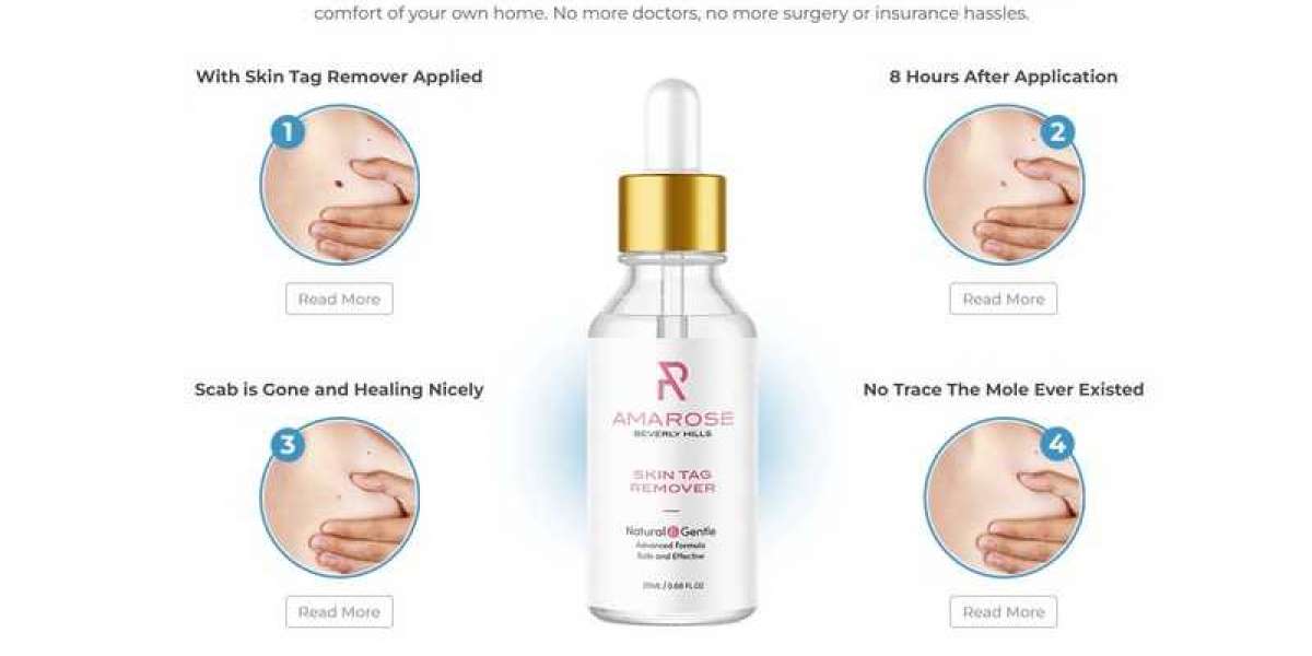 Seven Important Facts That You Should Know About Amarose Skin Tag Remover Reviews!