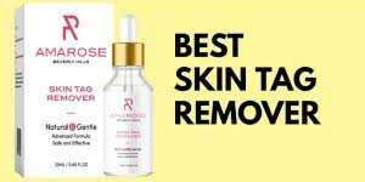 The Most Incredible Article About Paradise Skin Tag Remover You'll Ever Read