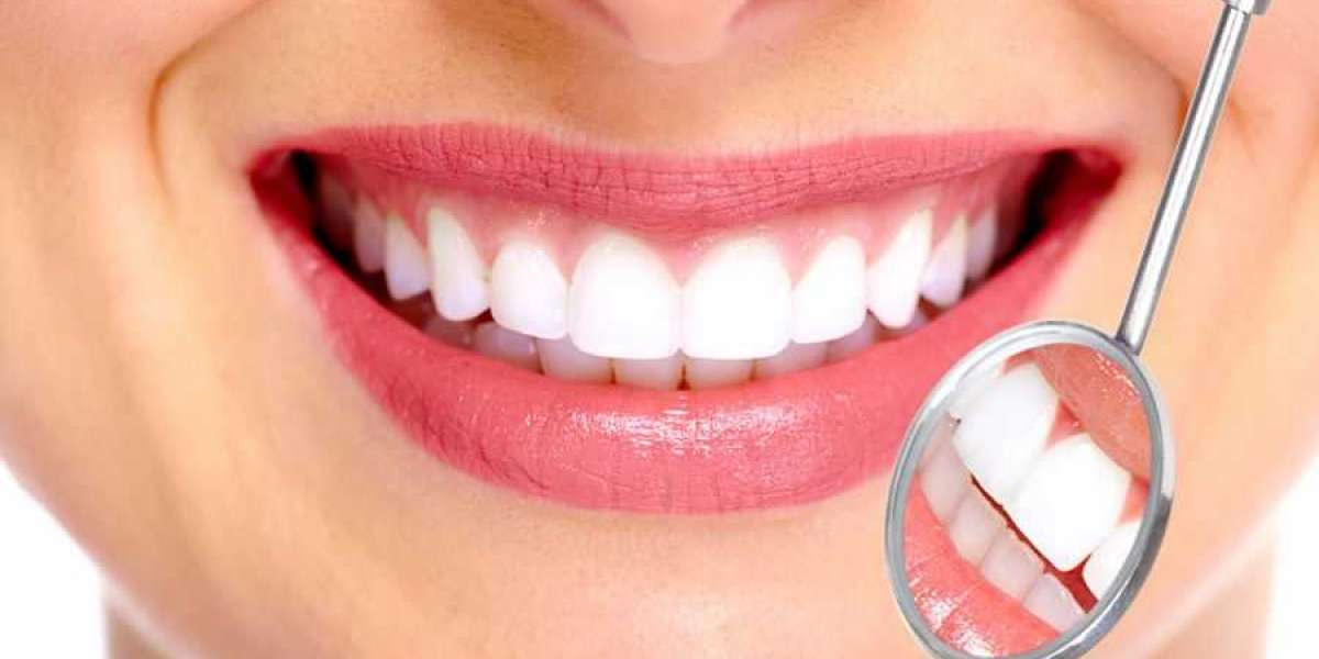 Why Dentist Kitchener Should Be Your Go-To for a Perfect Smile