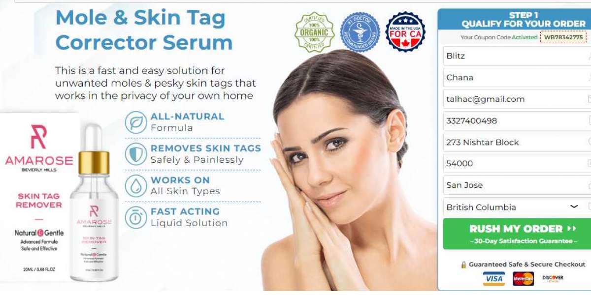 10 Reasons Why Shark Tank Skin Tag Remover is a Must-Have