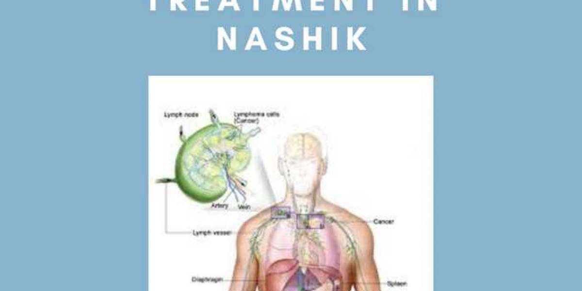Comprehensive Guide to Lymphoma Cancer Treatment in Nashik