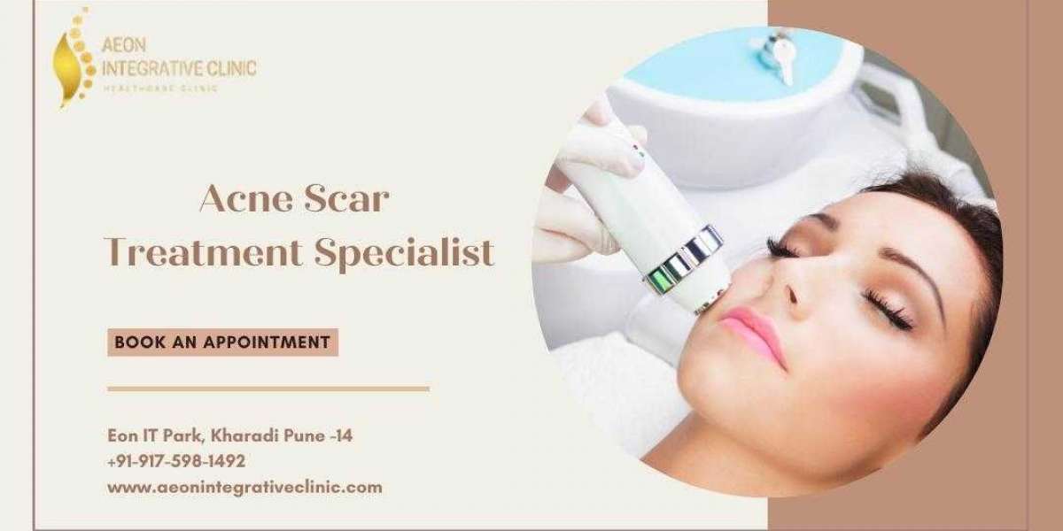 Achieving Clear Skin: Your Guide to Finding the Best Acne Scar Specialist in Pune