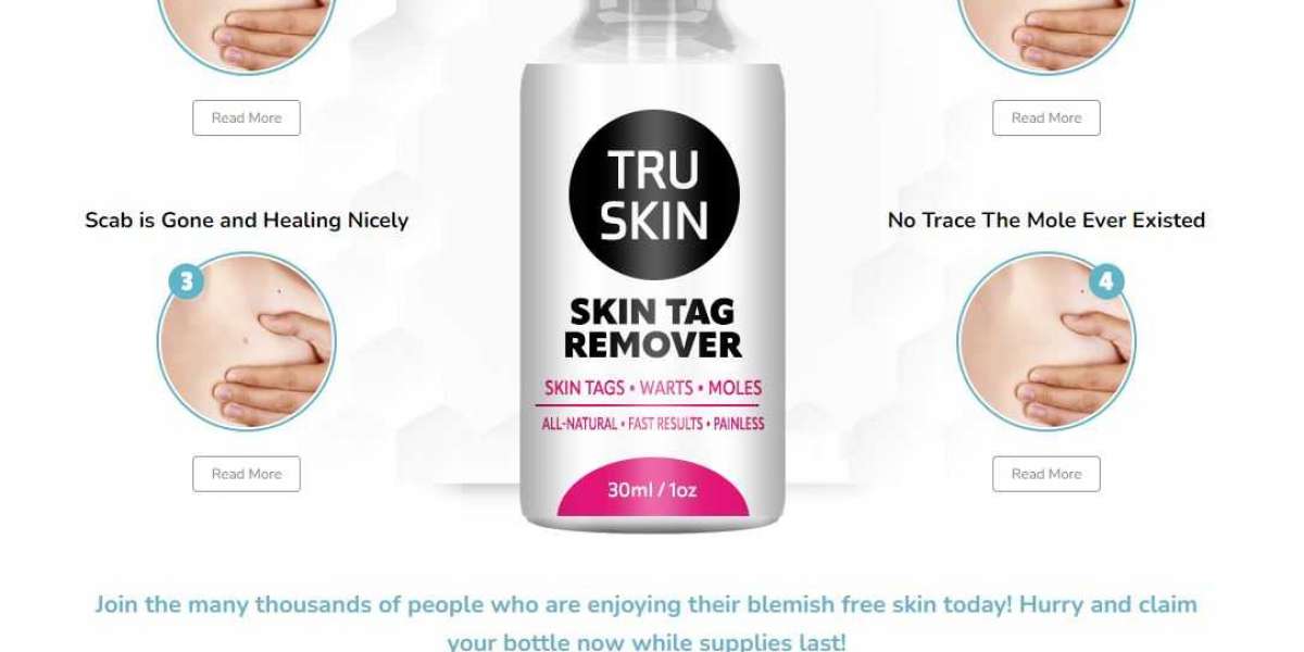 Tru Skin Tag Remover United States Key Ingredients: Nature's Arsenal Against Skin Tags