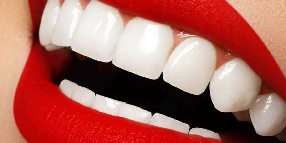 Reveal Your Perfect Smile: Dental Clinic Teeth Cleaning Price in Dubai