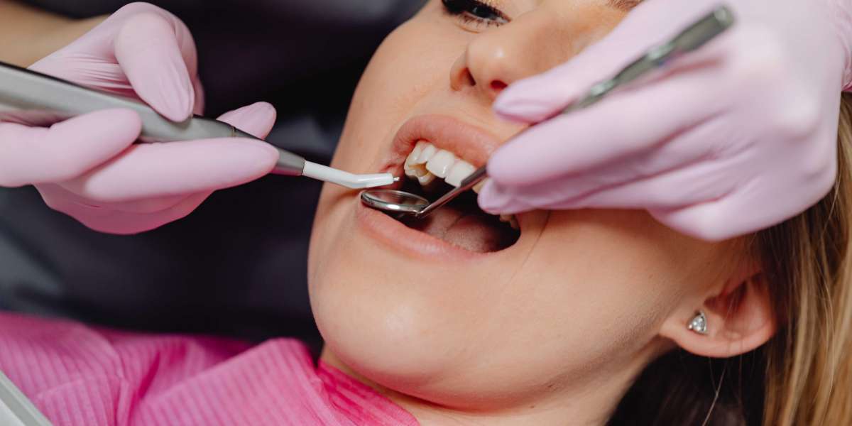 The Complete Guide to Dental Implants: Everything You Need to Know
