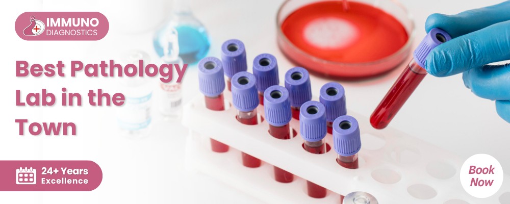 Diagnostic & Pathology Lab In Noida - Immuno Diagnostics