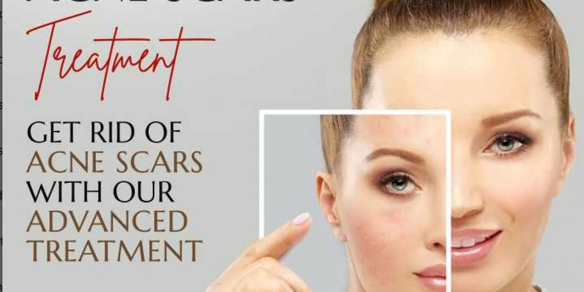 Cystic Acne: Causes, Symptoms and Treatment – Dr. Venkatesh Purohit (Dermatologist)